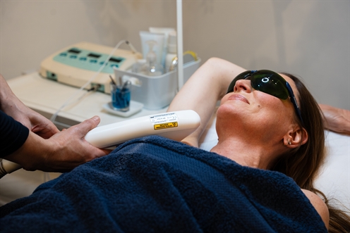 VPL Hair Removal Guide